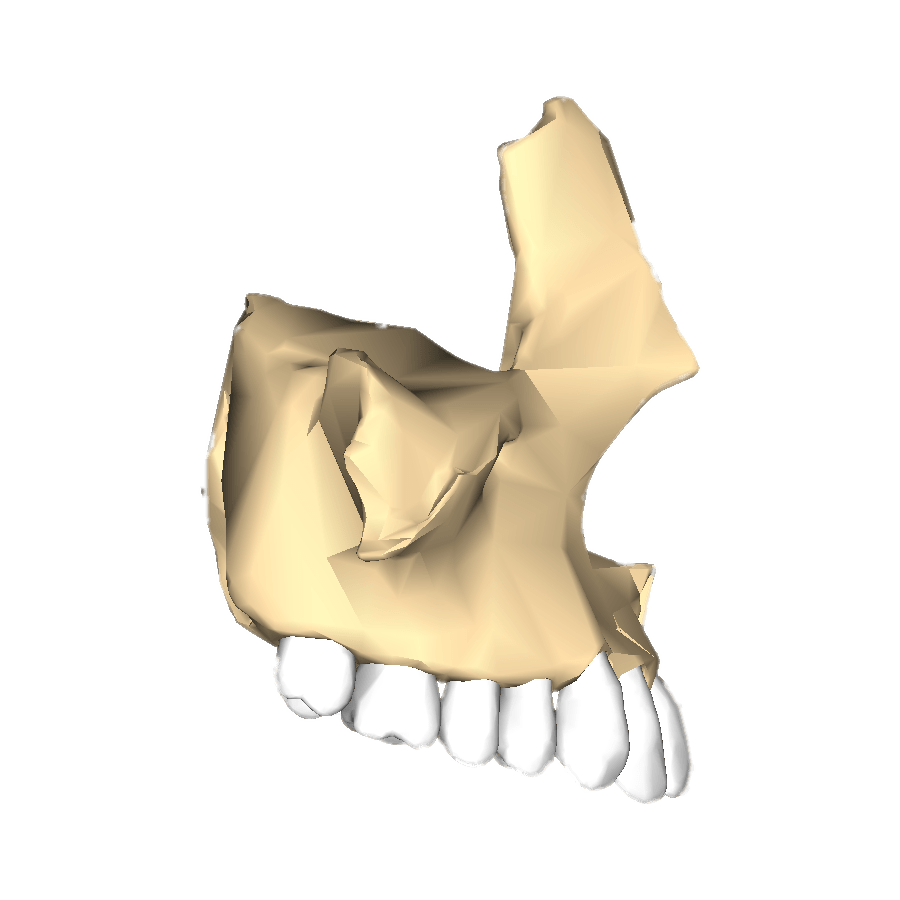 Maxilla Lateral