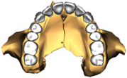 Maxilla Inferior