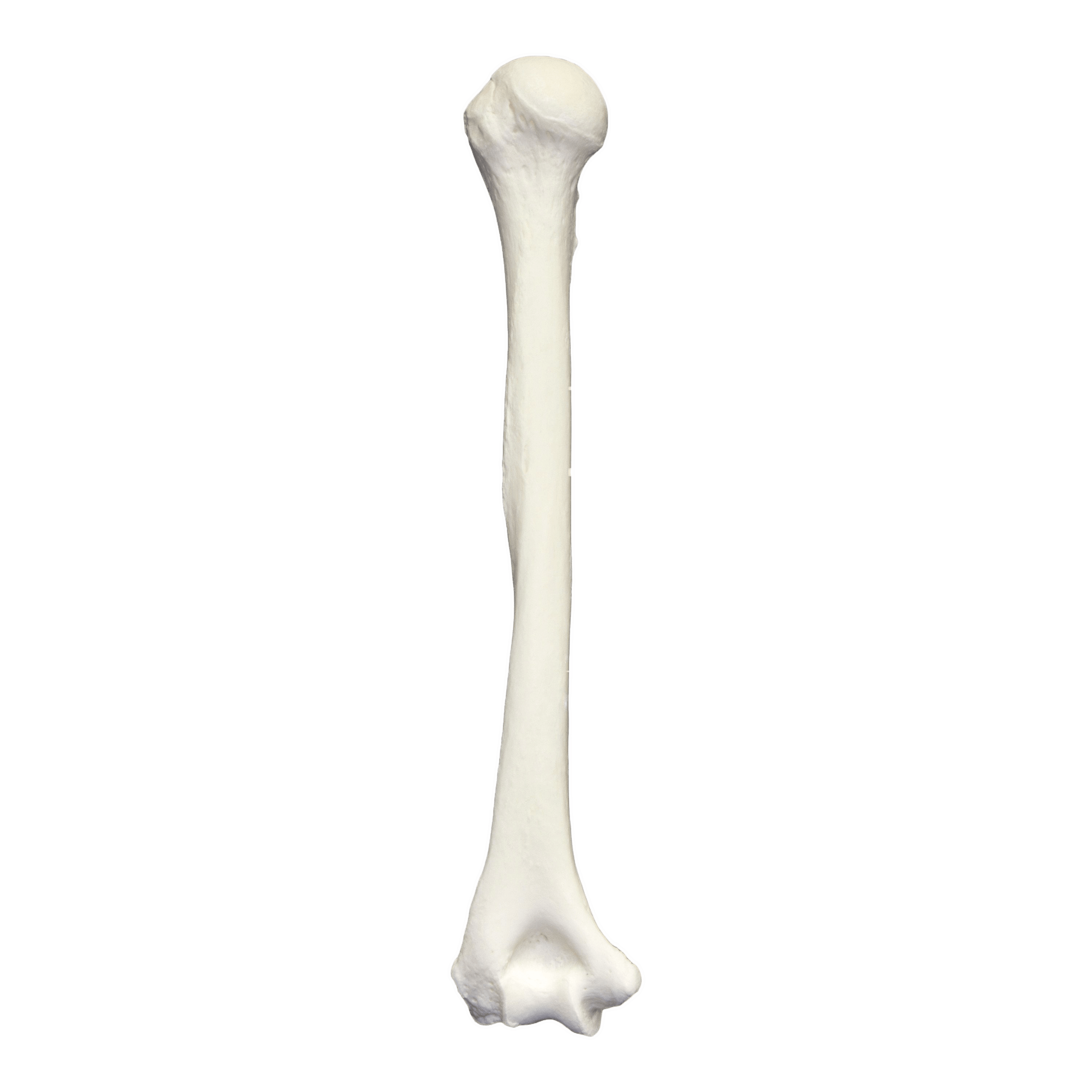 Humerus Bone