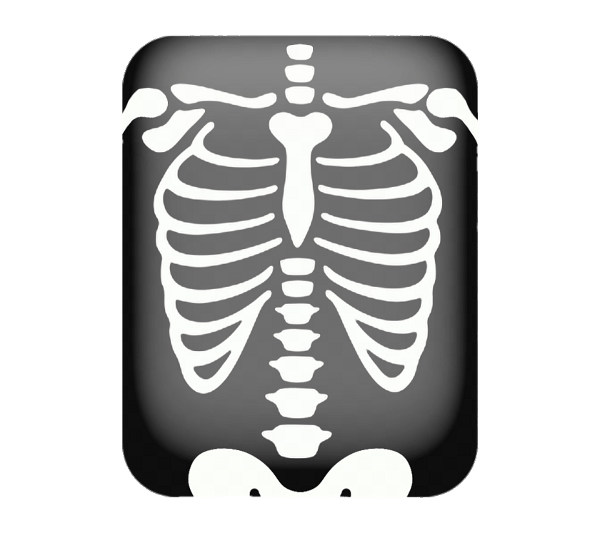 X-ray of Chest Clipart