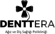 Denttera Ağız ve Diş Sağlığı Polikliniği, Denttera Diş Kliniği Çankaya