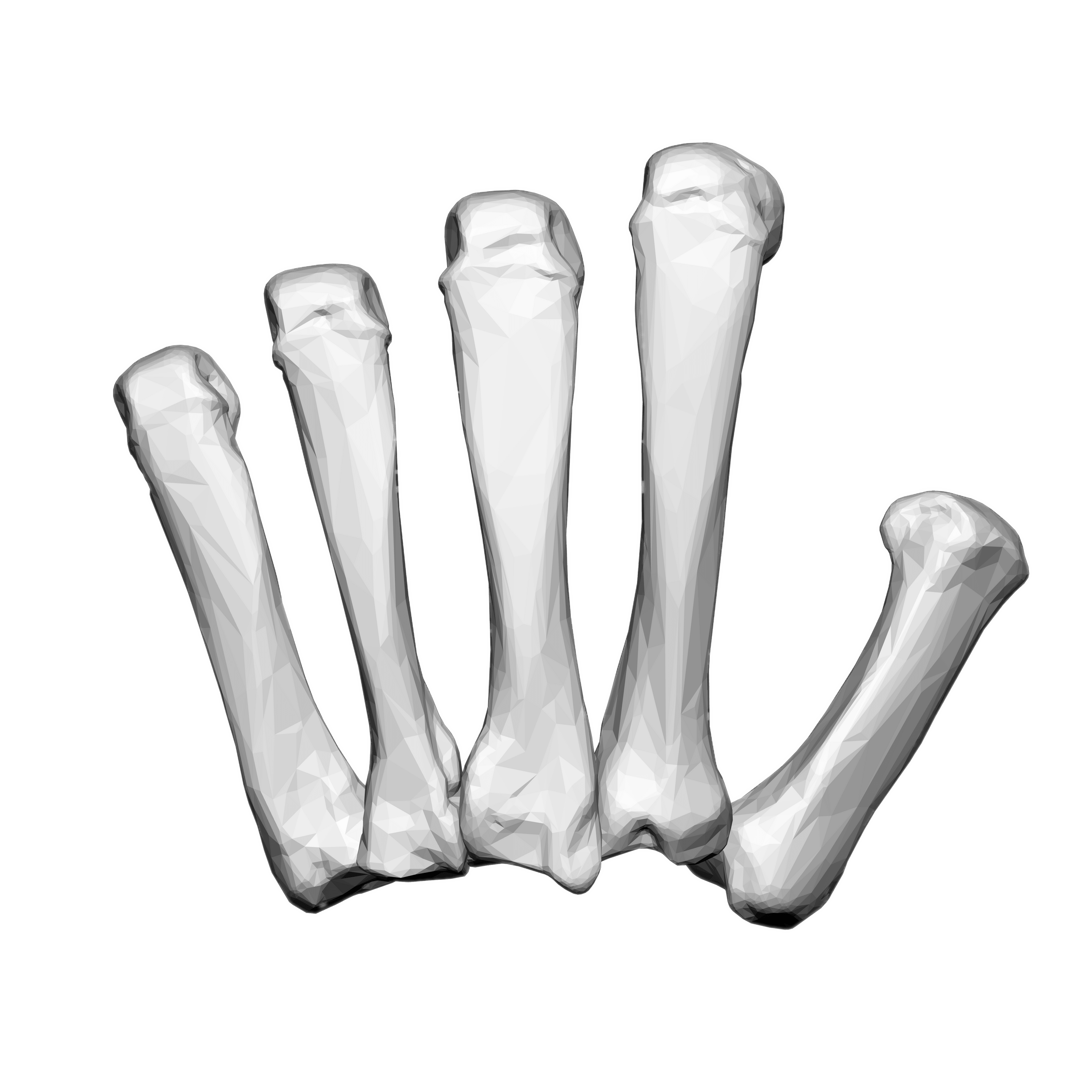 Left Hand Carpal Bones
