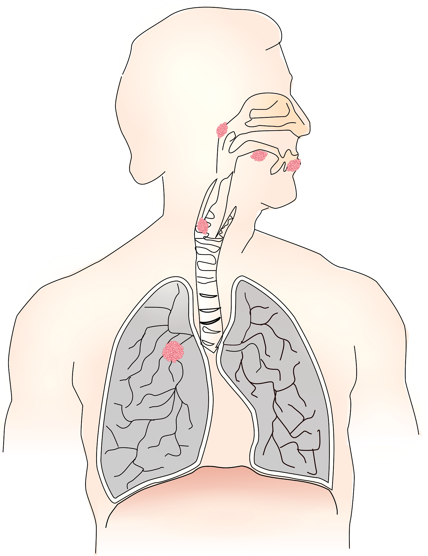 Lungs and Respiratory System