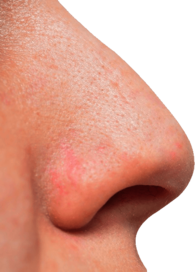 Large White Man Nose