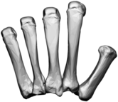 Left Hand Carpal Bones