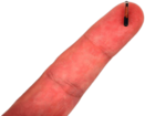 Microchip Implant on Fingertip