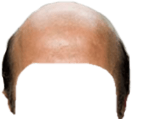 Bald Head Snapchat Filter