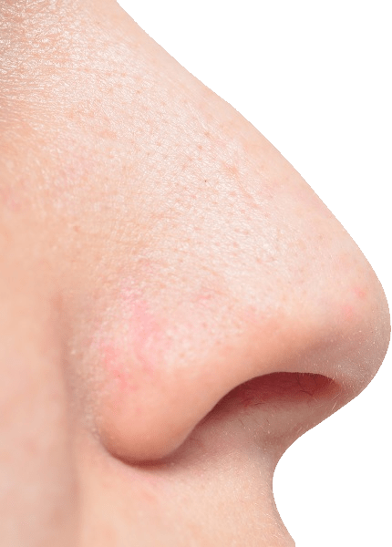 Large White Man Nose