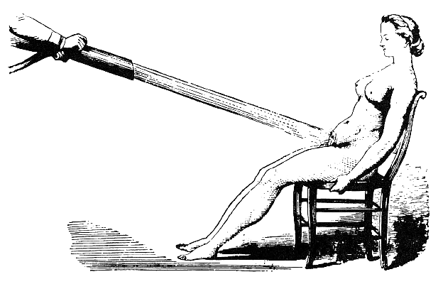 Pelvic Douche Victorian Remedy Against Hysteria