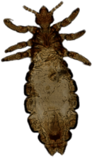 Head Louse