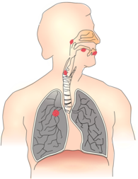 Lungs and Respiratory System