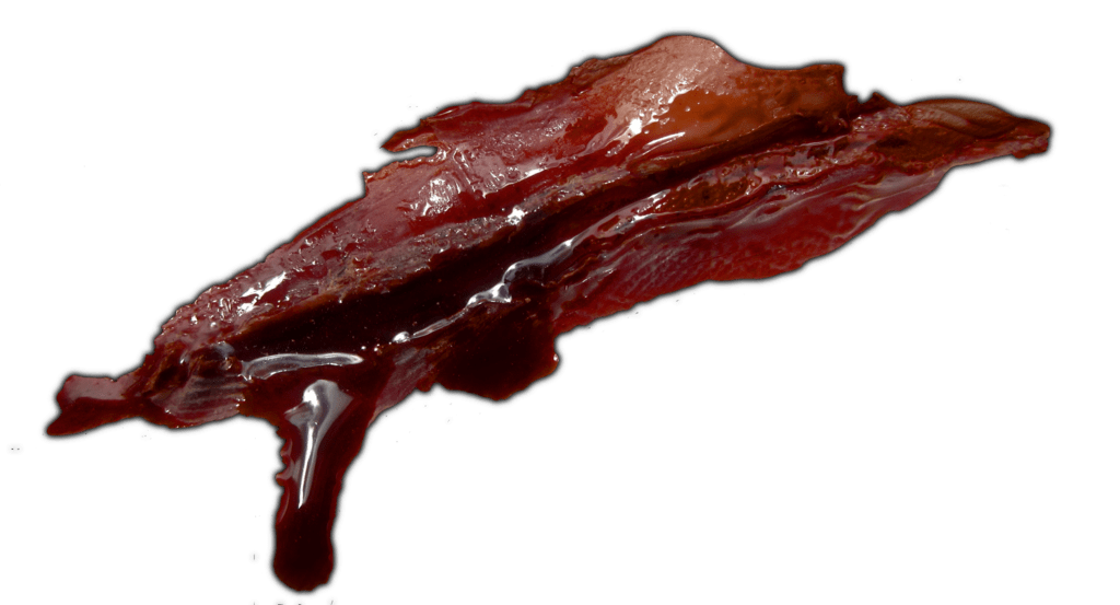 Bloody Wound