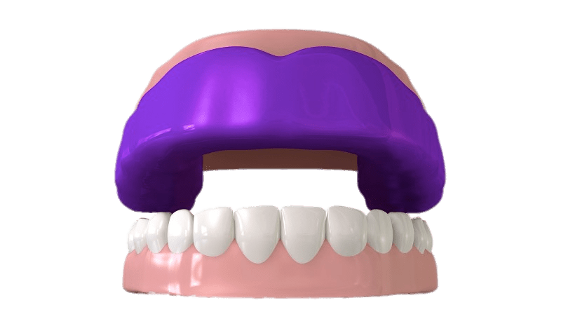 Mouthguard on Top Teeth Illustration